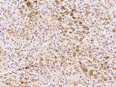 Immunohistochemistry-Paraffin: CABC1 Antibody [NBP2-99118]