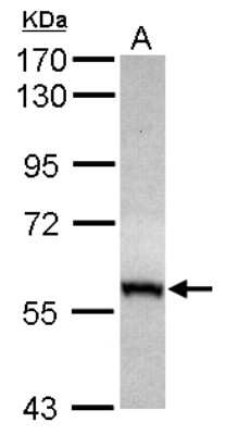 Western Blot: CABC1 Antibody [NBP2-15659]