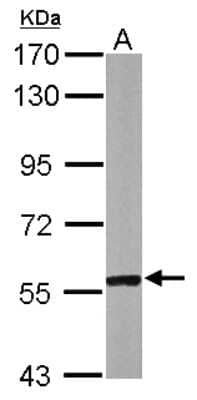 Western Blot: CABC1 Antibody [NBP2-15659]