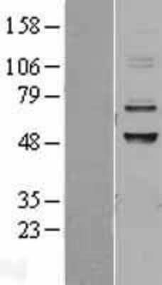 Western Blot: CABC1 Overexpression Lysate [NBL1-08622]