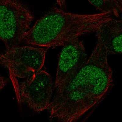 Immunocytochemistry/ Immunofluorescence: CABLES1 Antibody [NBP2-68962]