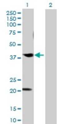 Western Blot: CABLES1 Antibody [H00091768-B01P]