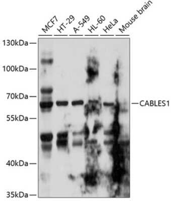 Western Blot: CABLES1 AntibodyBSA Free [NBP2-92697]