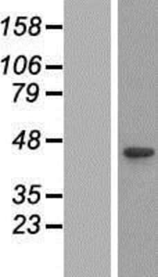 Western Blot: CABLES1 Overexpression Lysate [NBP2-05665]