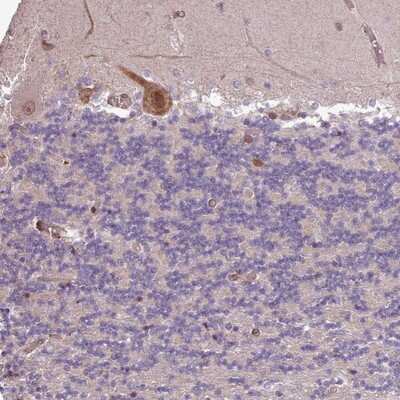 Immunohistochemistry-Paraffin: CABP1 Antibody [NBP2-14428]