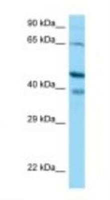 Western Blot: CABP1 Antibody [NBP1-98550]