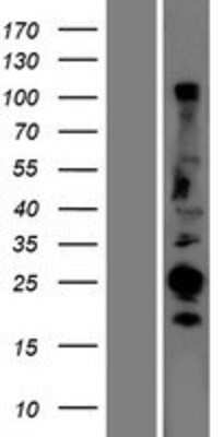 Western Blot: CABP1 Overexpression Lysate [NBP2-06144]