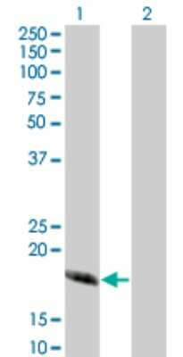 Western Blot: CABP4 Antibody (5G11) [H00057010-M02]