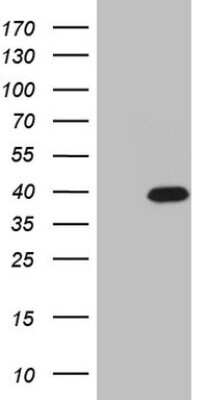 Western Blot: CABP4 Antibody (OTI9A7) [NBP2-46054]