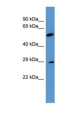 Western Blot: CABP4 Antibody [NBP1-68994]