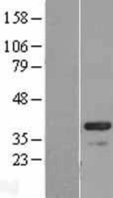 Western Blot: CABP4 Overexpression Lysate [NBL1-08624]