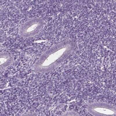 Immunohistochemistry-Paraffin: CABP5 Antibody [NBP1-86691]