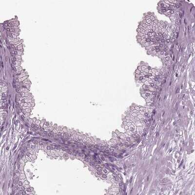 Immunohistochemistry-Paraffin: CABP5 Antibody [NBP1-86691]