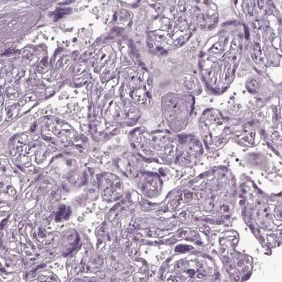 Immunohistochemistry-Paraffin: CABP5 Antibody [NBP1-86691]