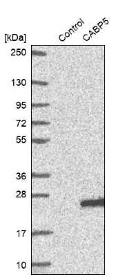 Western Blot: CABP5 Antibody [NBP1-86691]