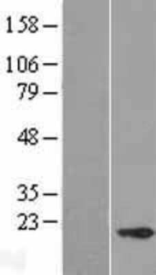 Western Blot: CABP5 Overexpression Lysate [NBP2-06699]