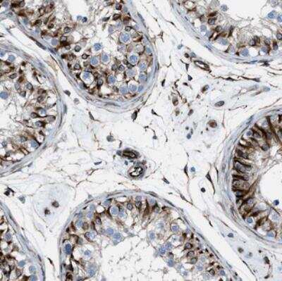 Immunohistochemistry: CABP7 Antibody [NBP2-30383]