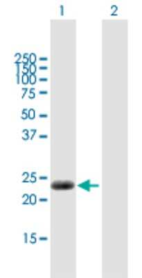 Western Blot: CABP7 Antibody [H00164633-B01P]