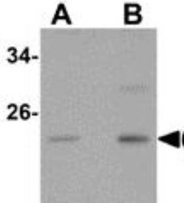 Western Blot: CABP7 AntibodyBSA Free [NBP1-77191]