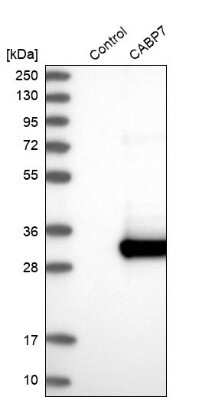 Western Blot: CABP7 Antibody [NBP2-30383]