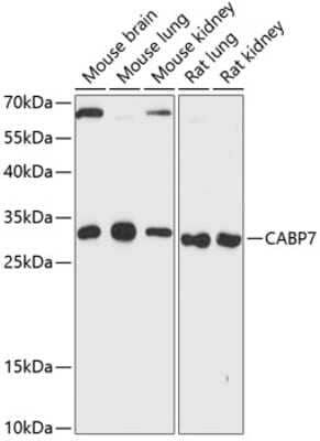 Western Blot: CABP7 AntibodyAzide and BSA Free [NBP2-92722]