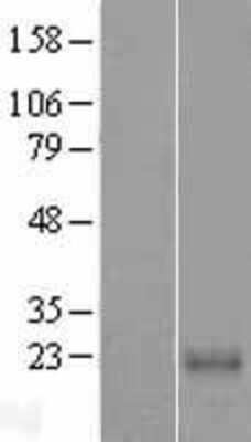 Western Blot: CABP7 Overexpression Lysate [NBL1-08625]