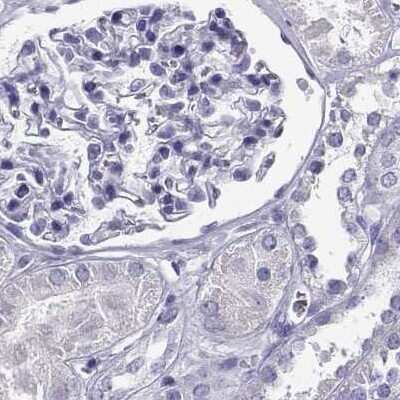 Immunohistochemistry-Paraffin: CABS1 Antibody [NBP1-91743]