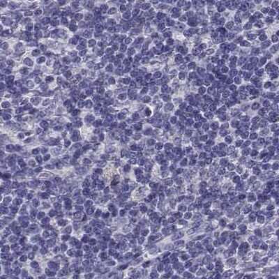 Immunohistochemistry-Paraffin: CABS1 Antibody [NBP2-33750]