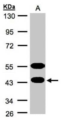 Western Blot: CABS1 Antibody [NBP1-31573]