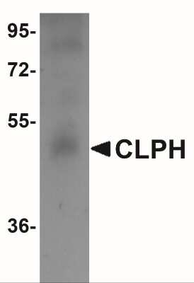 Western Blot: CABS1 AntibodyBSA Free [NBP1-77091]