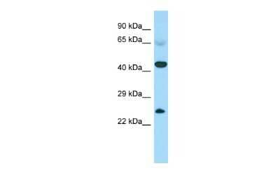 Western Blot: CABS1 Antibody [NBP3-10715]