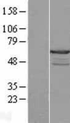 Western Blot: CABS1 Overexpression Lysate [NBL1-08476]