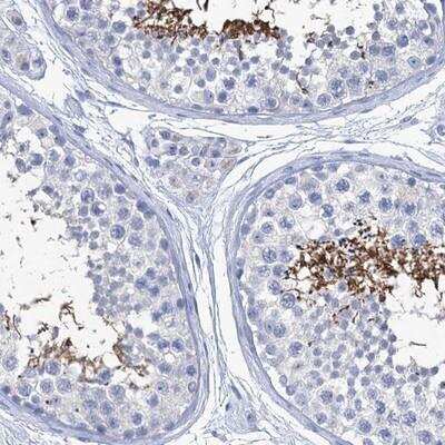 Immunohistochemistry-Paraffin: CABYR Antibody [NBP2-14429]