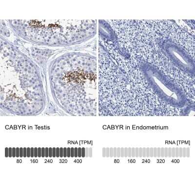 Immunohistochemistry-Paraffin: CABYR Antibody [NBP2-14429]