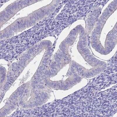 Immunohistochemistry-Paraffin: CABYR Antibody [NBP2-14430]