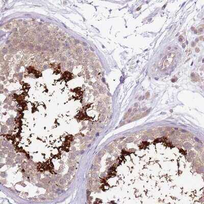 Immunohistochemistry-Paraffin: CABYR Antibody [NBP2-14430]
