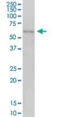 Western Blot: CABYR Antibody [H00026256-B01P]