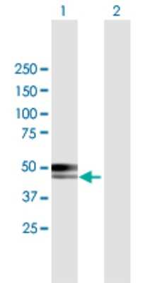 Western Blot: CABYR Antibody [H00026256-B01P]