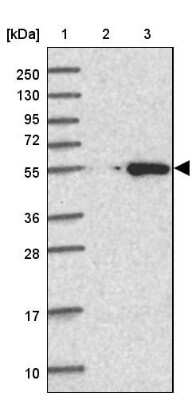 Western Blot: CABYR Antibody [NBP2-14430]