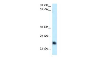 Western Blot: CABYR Antibody [NBP2-87108]