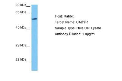 Western Blot: CABYR Antibody [NBP2-87109]