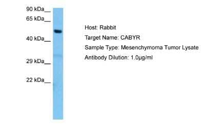 Western Blot: CABYR Antibody [NBP2-87110]