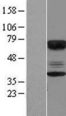 Western Blot: CABYR Overexpression Lysate [NBP2-07476]