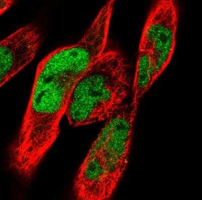 Immunocytochemistry/ Immunofluorescence: CAC1 Antibody [NBP2-76539]