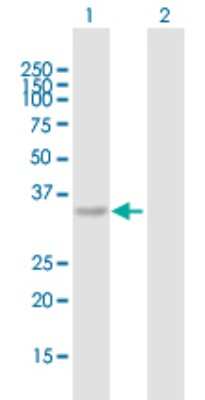 Western Blot: CAC1 Antibody [H00143384-B01P]
