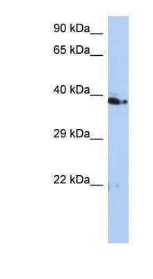 Western Blot: CAC1 Antibody [NBP1-58219]