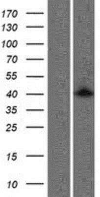 Western Blot: CAC1 Overexpression Lysate [NBP2-05228]