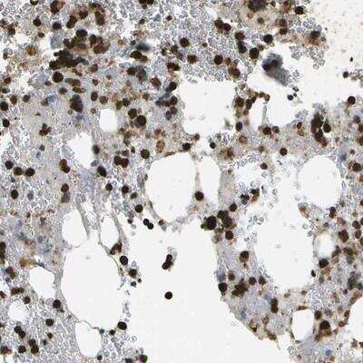 Immunohistochemistry-Paraffin: CACHD1 Antibody [NBP1-82902]