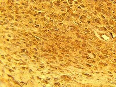 Immunohistochemistry: CACNA1G Antibody [NBP3-11923]