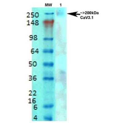 Western Blot: CACNA1G Antibody (S178A-9) [NBP2-59322]